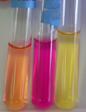 Urea agar base